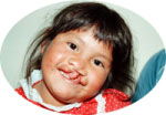 Margarita before
surgery.
